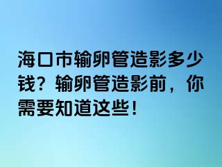 ?？谑休斅压茉煊岸嗌馘X？輸卵管造影前，你需要知道這些！